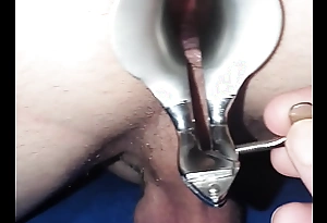 Douche was in time to speculum